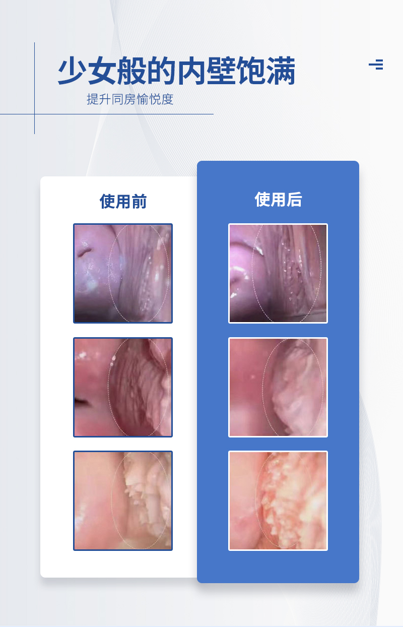 姬时代草本抑菌凝胶私处清洁护理女性妇科凝胶(图5)